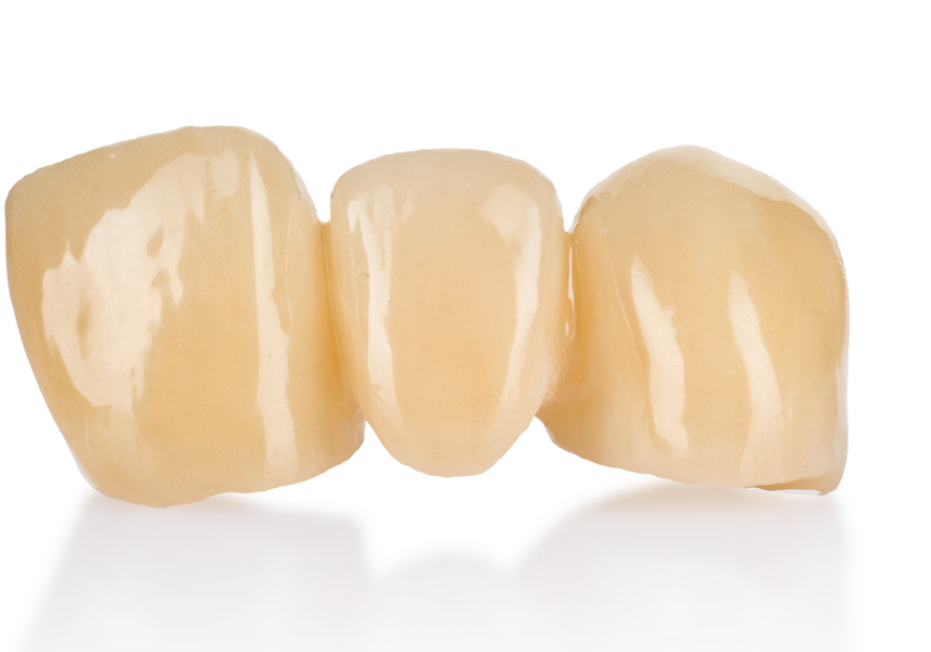 Mão và cầu răng