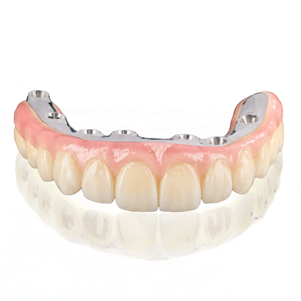 Dental Implant