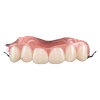 Acrylic Partial Denture