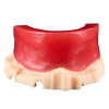 Bite Block