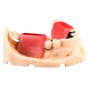 Bite Rim