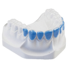 Bleaching Tray
