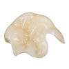 Emax Crown