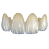 Esthetic Multilayer Zirconia