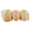 Layered Zirconia