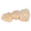 Monolithic Zirconia