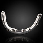 Full Arch Implant Prosthesis