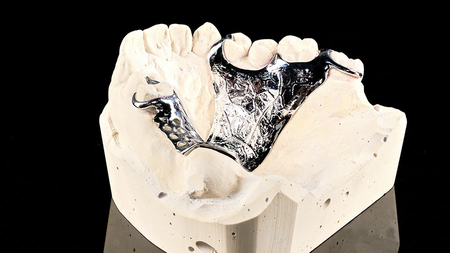 Framework Materials In Dentistry: A Comprehensive Overview