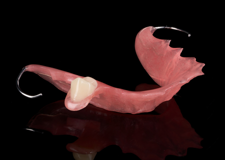 Acrylic Removable Partial Denture