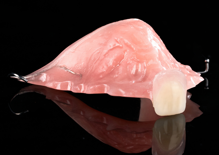 Acrylic Removable Partial Denture