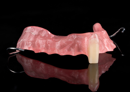Acrylic Removable Partial Denture