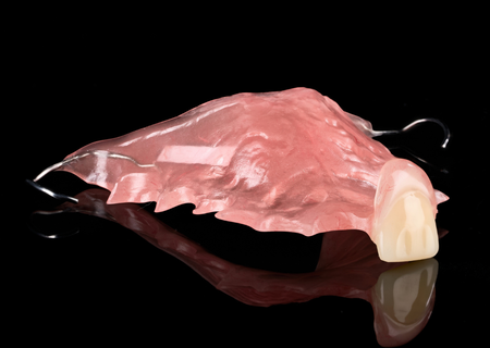 Acrylic Removable Partial Denture
