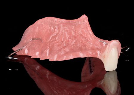 Acrylic Removable Partial Denture