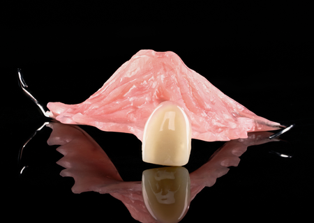 Acrylic Removable Partial Denture