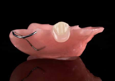 Acrylic Removable Partial Denture
