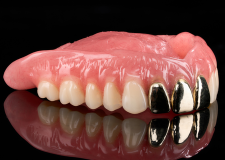 Acrylic Removable Partial Denture