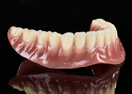 Acrylic Removable Partial Denture