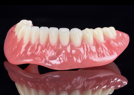 Acrylic Removable Partial Denture