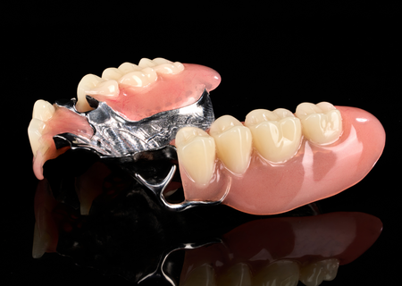 Acrylic Removable Partial Denture