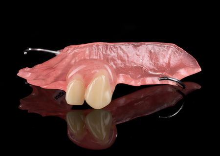 Acrylic Removable Partial Denture