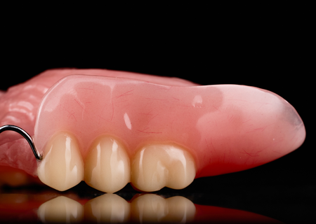 Acrylic Removable Partial Denture