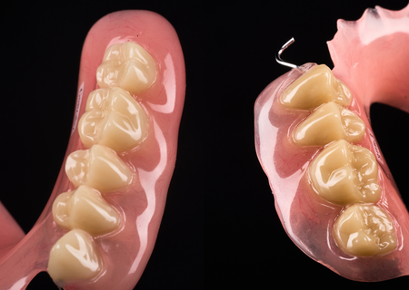 Acrylic Removable Partial Denture