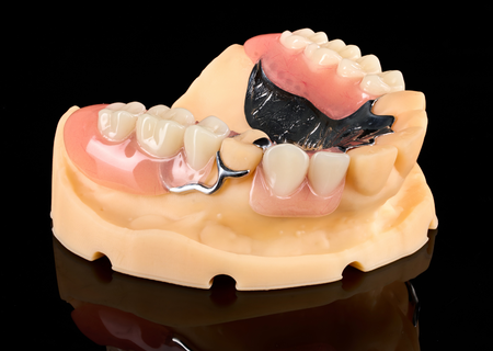 Acrylic Removable Partial Denture