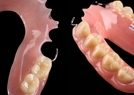 Acrylic Removable Partial Denture