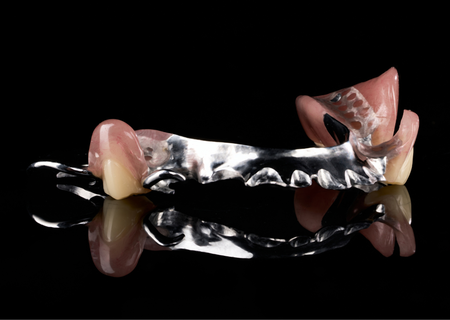 Acrylic Removable Partial Denture