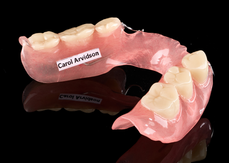 Acrylic Removable Partial Denture
