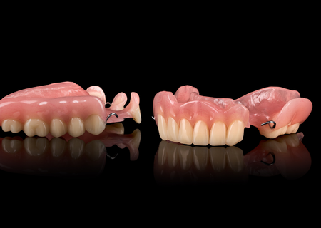 Acrylic Removable Partial Denture