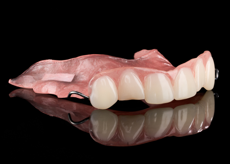 Acrylic Removable Partial Denture