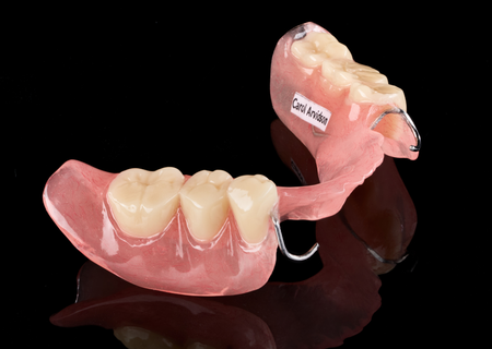 Acrylic Removable Partial Denture