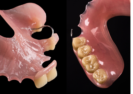 Acrylic Removable Partial Denture
