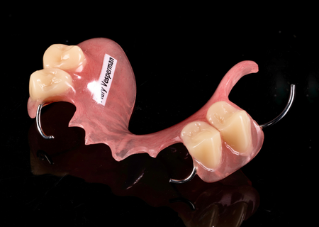 Acrylic Removable Partial Denture