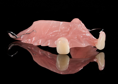 Acrylic Removable Partial Denture