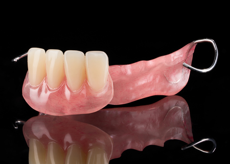 Acrylic Removable Partial Denture