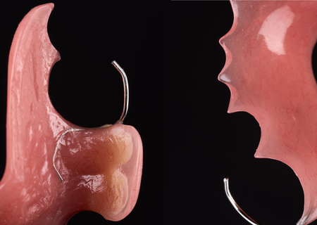 Acrylic Removable Partial Denture