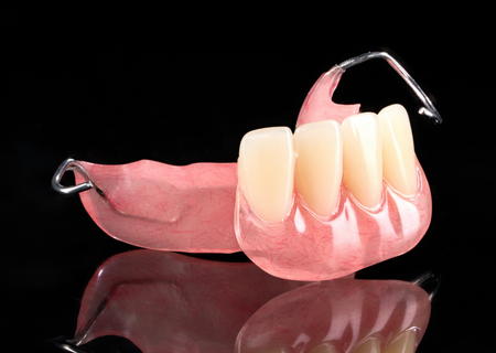 Acrylic Removable Partial Denture