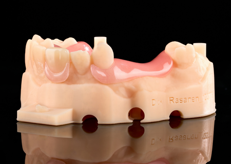 Acrylic Removable Partial Denture
