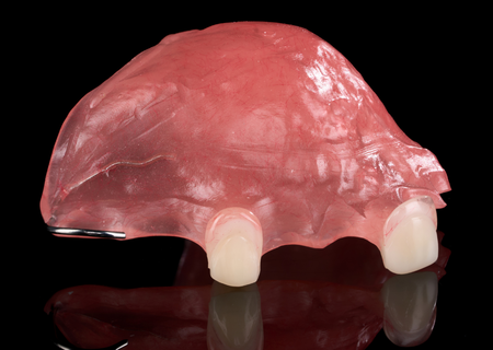 Acrylic Removable Partial Denture