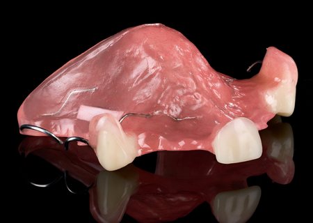 Acrylic Removable Partial Denture