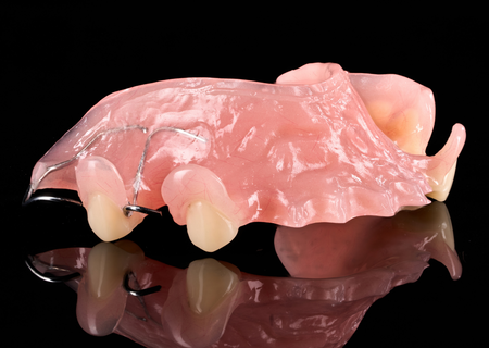 Acrylic Removable Partial Denture