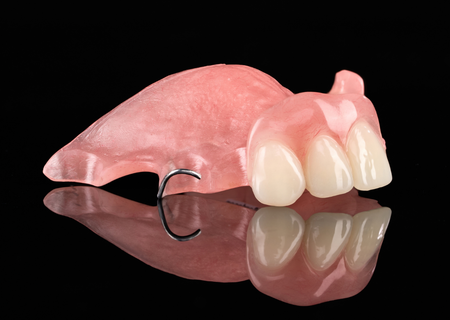 Acrylic Removable Partial Denture