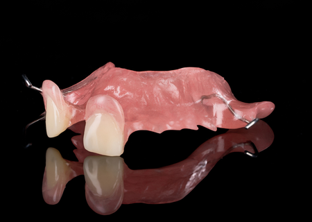 Acrylic Removable Partial Denture