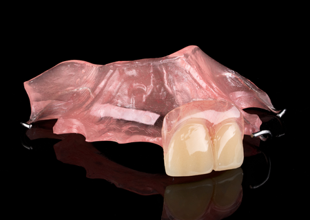 Acrylic Removable Partial Denture
