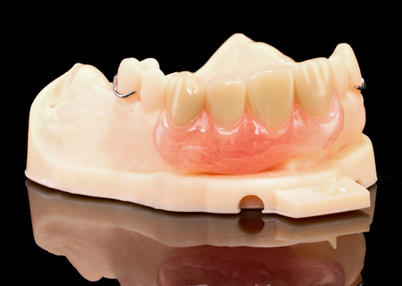 Acrylic Removable Partial Denture