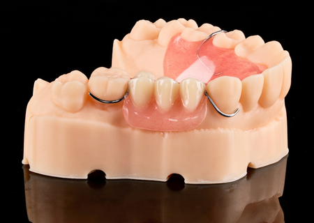 Acrylic Removable Partial Denture