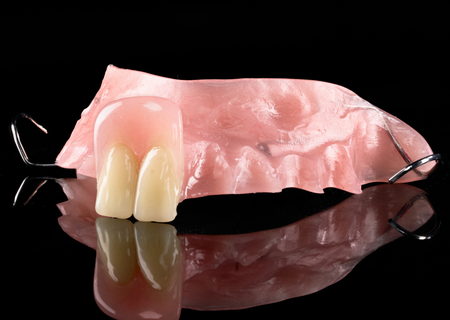 Acrylic Removable Partial Denture