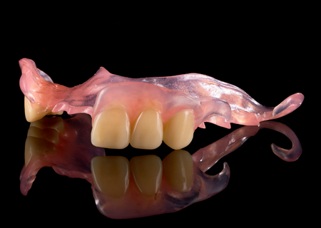 Flexible RPD
